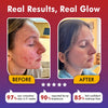 LumaSkin Pro 2.0 | LED Facial Mask