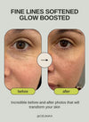 The Vita A Retinal Shot Tightening Booster | with Liposomized Retinal, Matryxyl, Pore Minimizer, Wrinkles & Fine Lines, Firmer Skin, 15ml